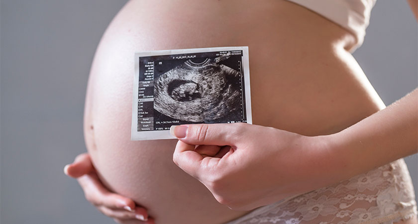 A imagem mostra, em primeiro plano, a mão de uma mulher de pele branca segurando uma imagem de ultrassom de um bebê. Ao fundo, mais desfocado, é possível ver a barriga da gestante. O fundo da imagem é cinza.